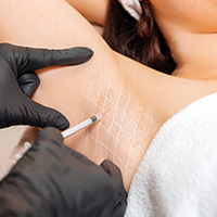 a beautician wearing black gloves administering a hyperhidrosis treatment via an injection to a woman's underarm