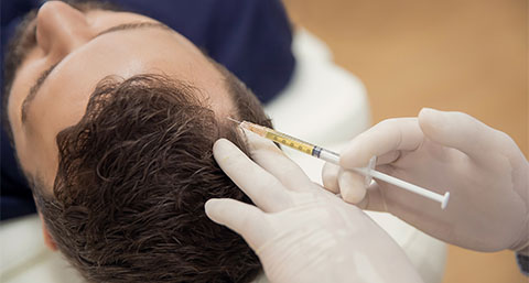 a man receiving a PRP injection to his scalp for a hair loss treatment